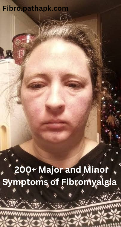200+ Major and Minor  Symptoms of Fibromyalgia