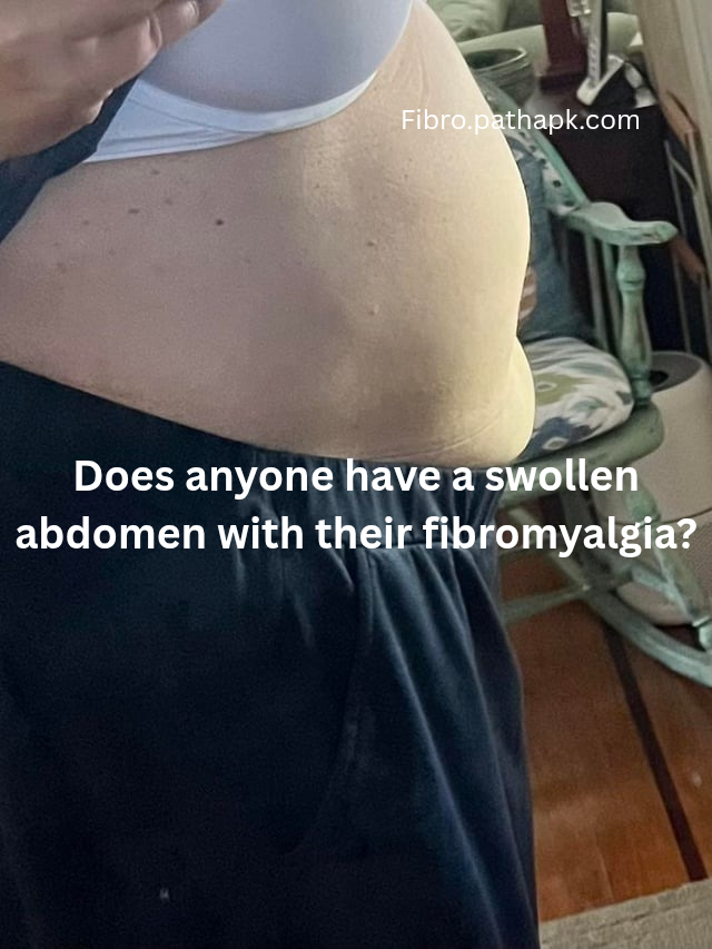 Does anyone have a swollen abdomen with their fibromyalgia?