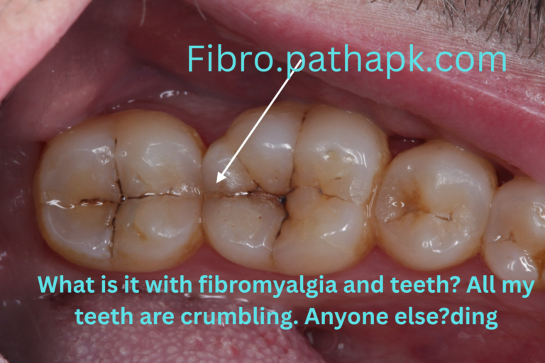 What is it with fibromyalgia and teeth? All my teeth are crumbling. Anyone else?