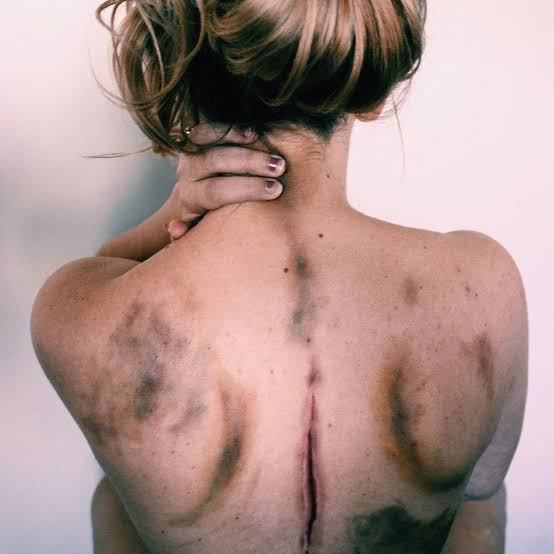 “You Look Fine”—The 16 Painful Truths About Fibromyalgia That Nobody Sees.