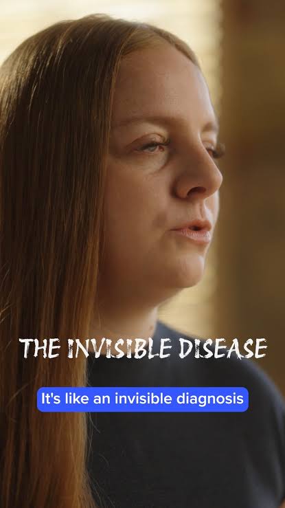 Fibromyalgia: examining invisible pain
