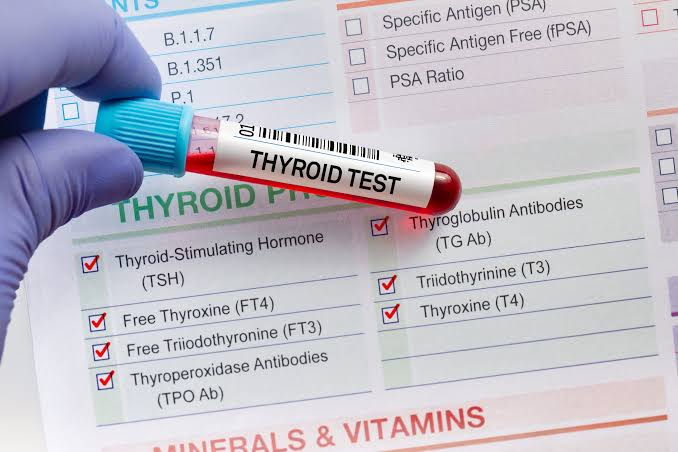 Thyroid Test Analyzer: Are Your T3, T4, or TSH Levels Normal?
