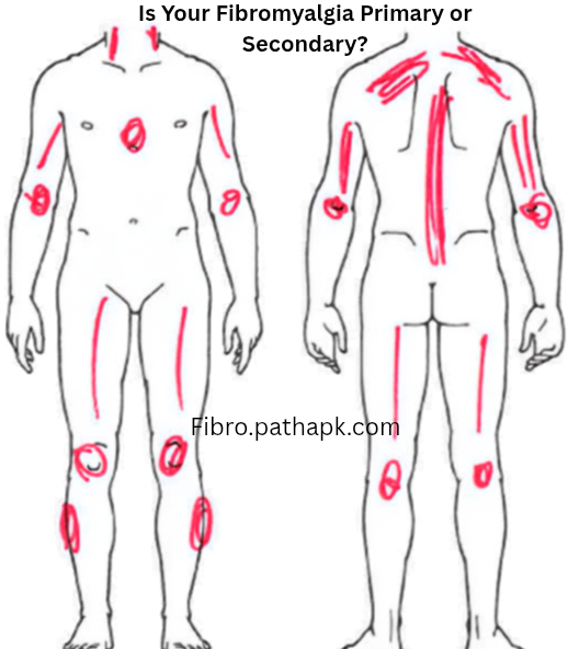 Is Your Fibromyalgia Primary or Secondary?