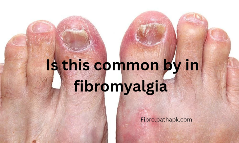 Is this common by in fibromyalgia