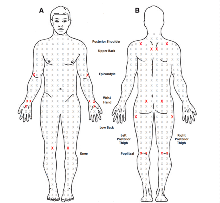 From Years of Pain to a Name: Fibromyalgia Uncovered 