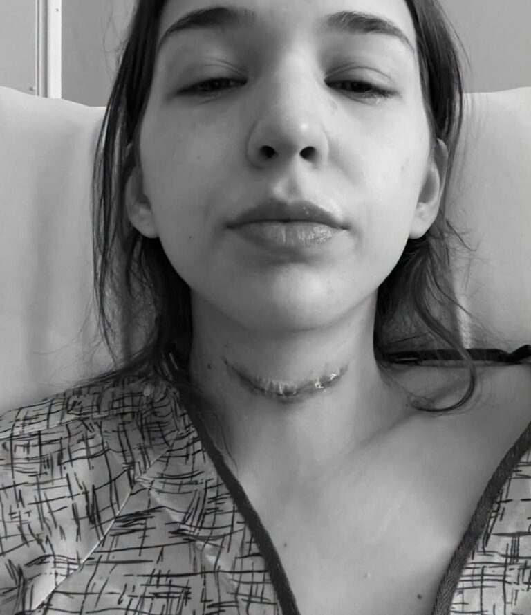 Thyroid problems are weird.