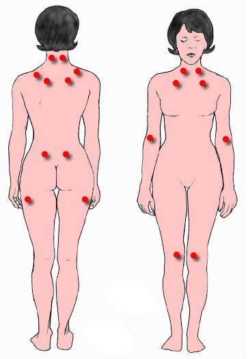 Trigger Warning