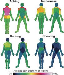 Which part of your body is most often affected by fibromyalgia pain?