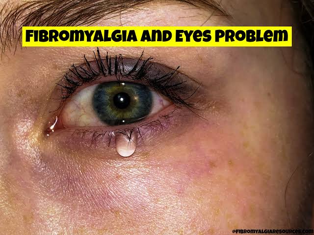 Dry and irritated eyes. Why Does Fibromyalgia Affect the Eyes?