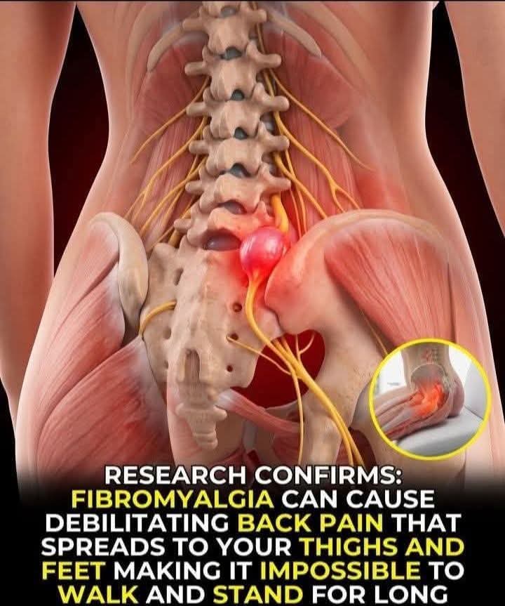 Research confirms that fibromyalgia can make back pain feel severe, spreading, and completely exhausting